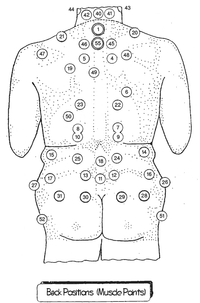 Cupping Placement Chart
